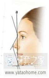 正畸医生如何指定方案的,正畸医生怎么说