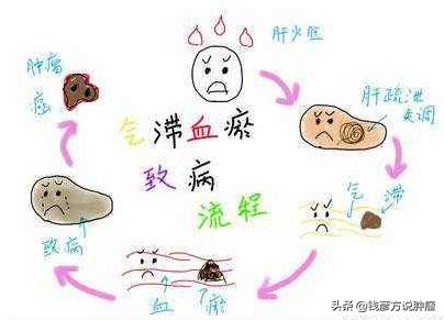 喝中药能消除结节息肉吗,结节息肉气滞血瘀