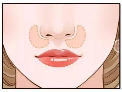 贵族手术的好处,鼻基底手术失败凹陷怎么改善