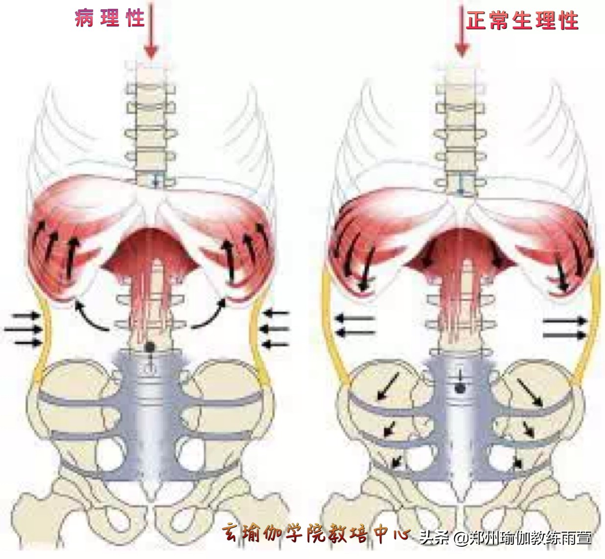 肋骨外翻会有后背疼是怎么回事,右侧肋骨外翻隐痛要警惕三种病