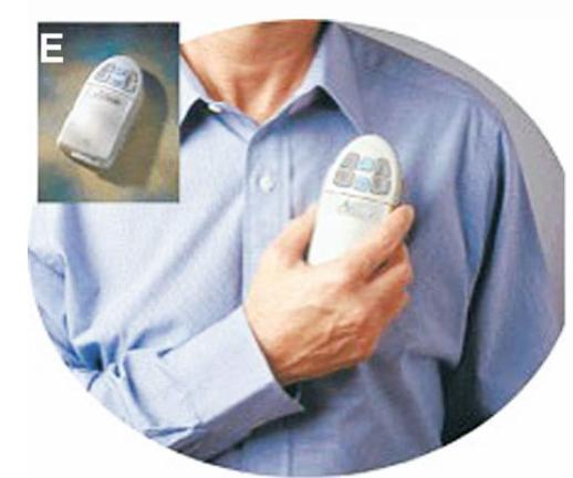 帕金森患者脑深部电刺激护理,帕金森脑深部电刺激手术步骤