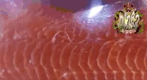 深圳2兄妹身上频现“离奇淤青”，医生：可能是吃出来的！咋回事