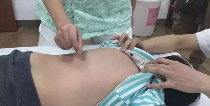 祝你快高长大：刘医生小儿增高临床心得