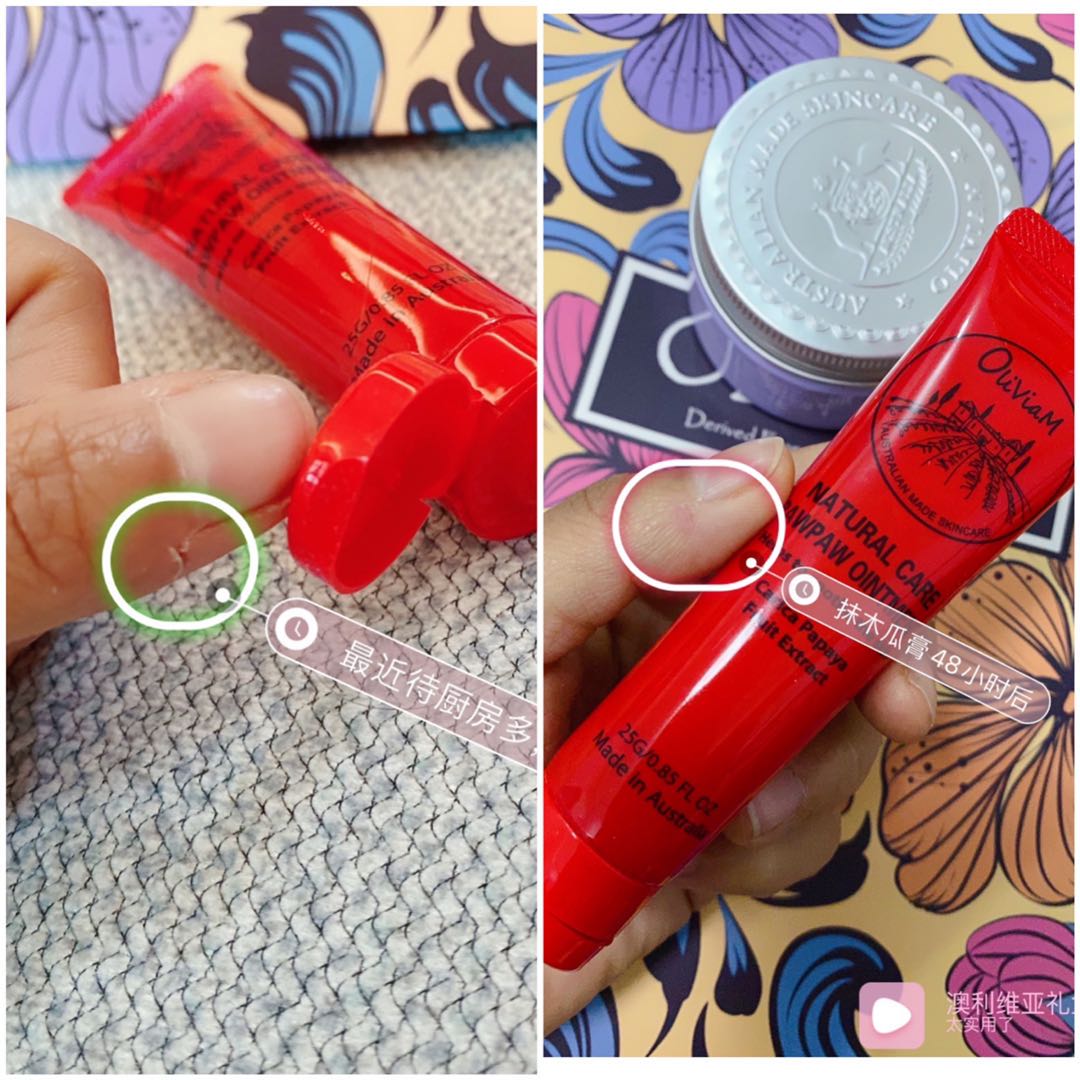 澳洲木瓜膏可以祛痘么,澳洲木瓜膏真的可以祛痘痘吗