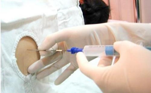 7张图揭露产妇“剖腹产”全过程，男人都该看，网友：母爱太伟大