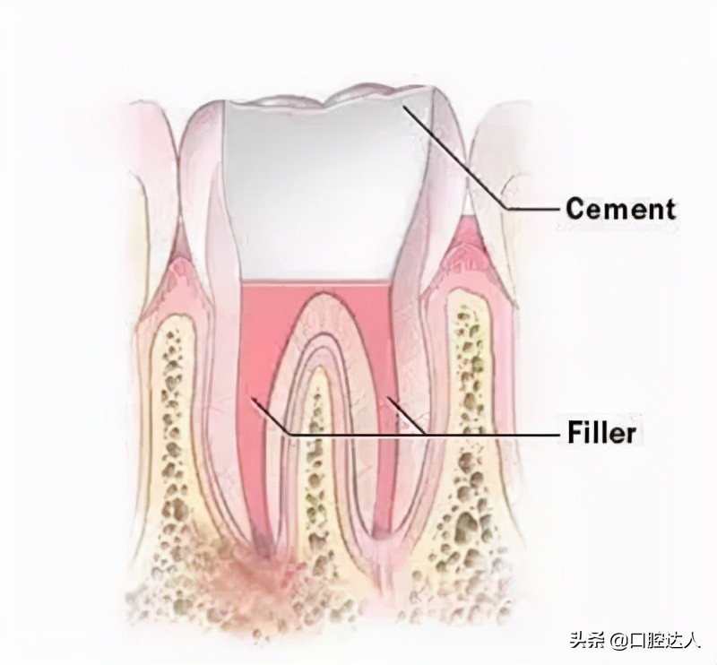 牙齿发炎有脓水用什么消炎药,孕早期牙齿发炎能吃什么消炎药