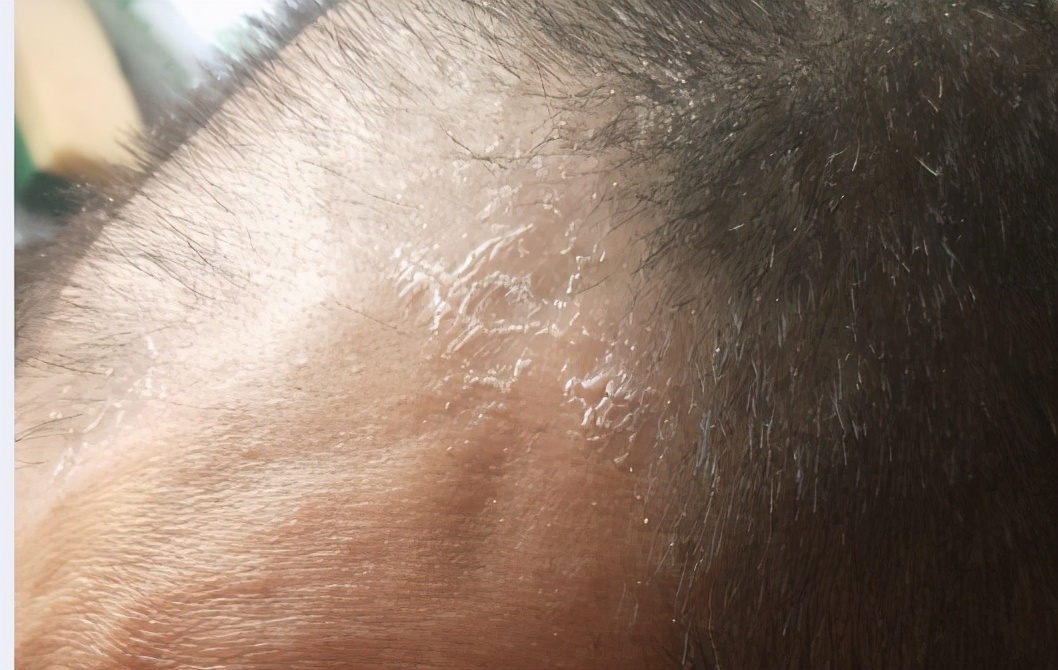 鱼刺卡喉祖传秘方求救,鱼刺卡喉轻松解决快1年了