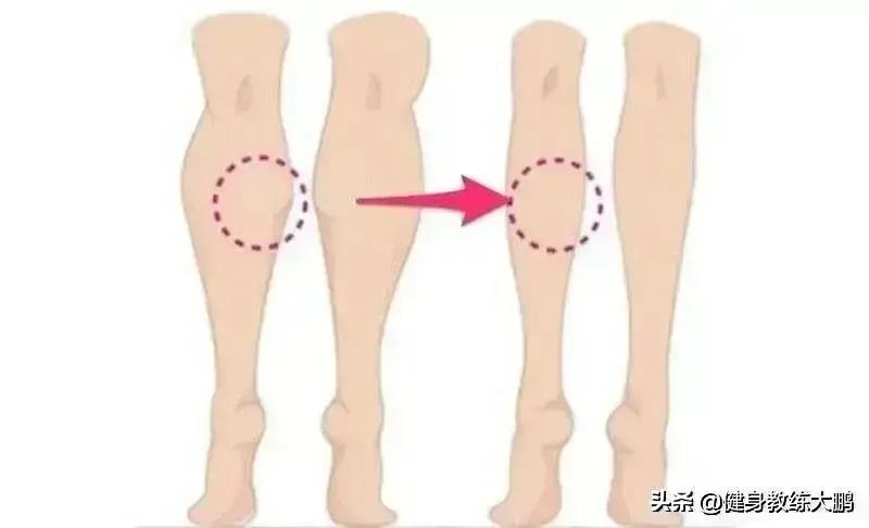 为什么小腿总是减不下去,为什么小腿这么难减下来
