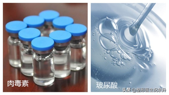 玻尿酸和肉毒素填充法令纹全过程,法令纹应该打肉毒素还是玻尿酸