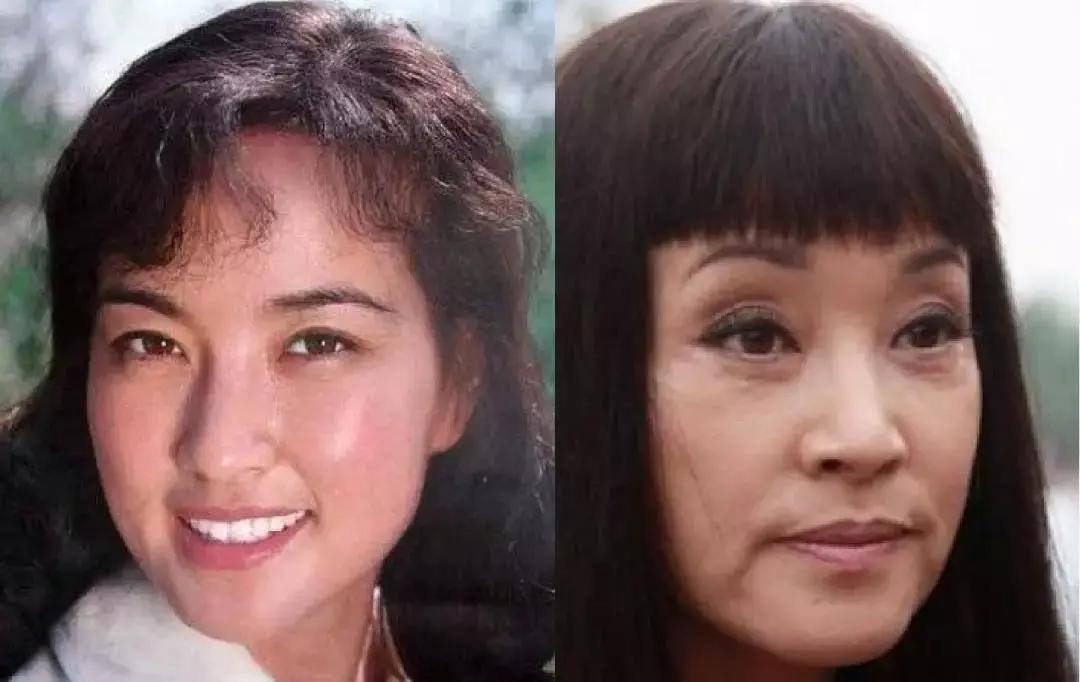 抗衰老预防垮脸,抗皱抗衰去细纹有哪些