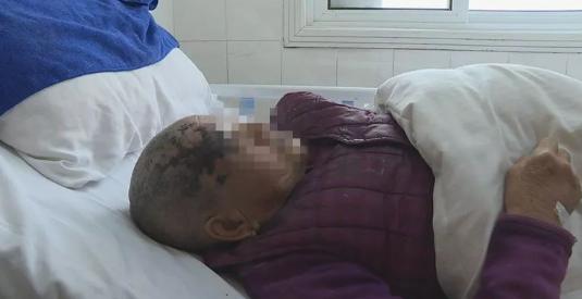 看到泗阳这名老太的样子，你还敢相信偏方吗？