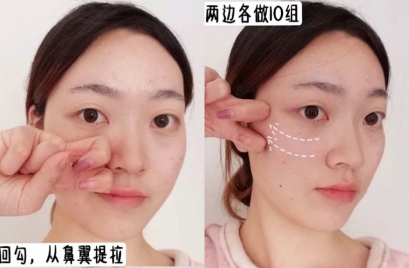 法令纹怎么改善瘦脸,法令纹改善手法