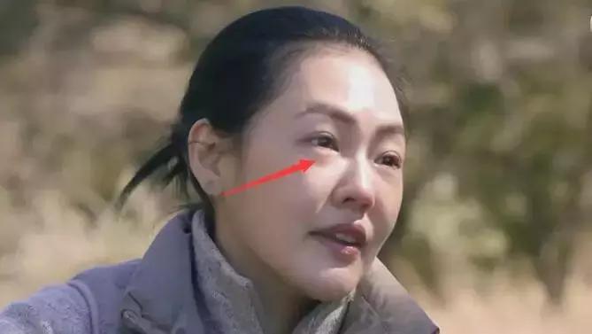 眼袋怎么消除简单方法男生,黑眼袋怎么消除最快方法男士