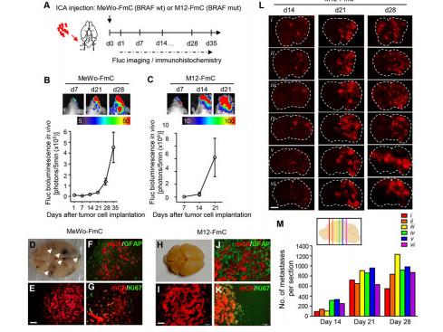 干细胞治疗帕金森病最新消息,2022年世界帕金森日主题视频