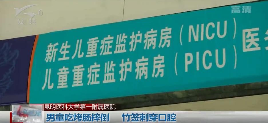一根烤肠险些要了这个宝宝的命！8厘米竹签从口腔刺破咽喉，尖端险些刺入生命中枢