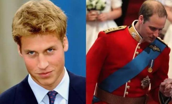 贝克汉姆秃了头,贝克汉姆秃了视频