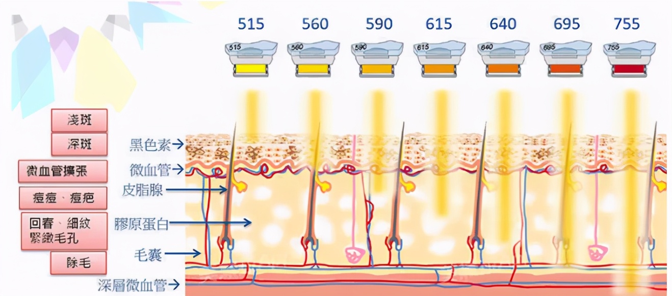 医美能从光子嫩肤开始,医美光子嫩肤是干啥的