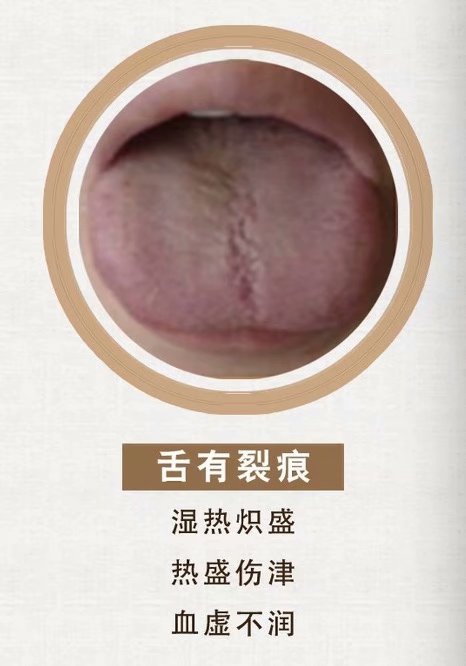 舌诊脉诊分析合集,舌诊实战分析