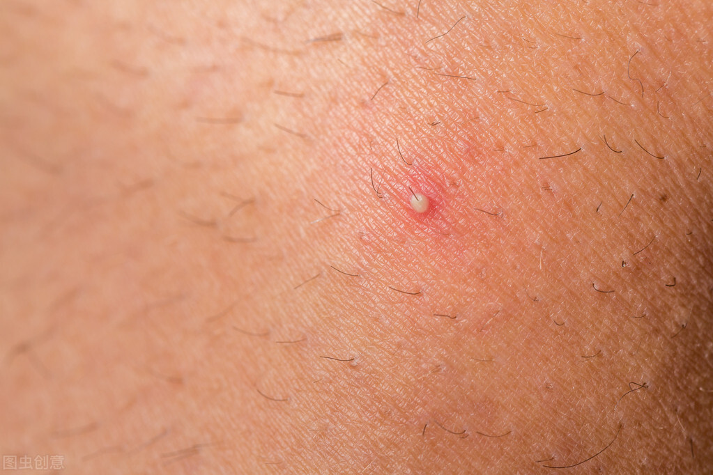 别人坐热的板凳不能马上坐,别人坐热的凳子能直接坐下去吗