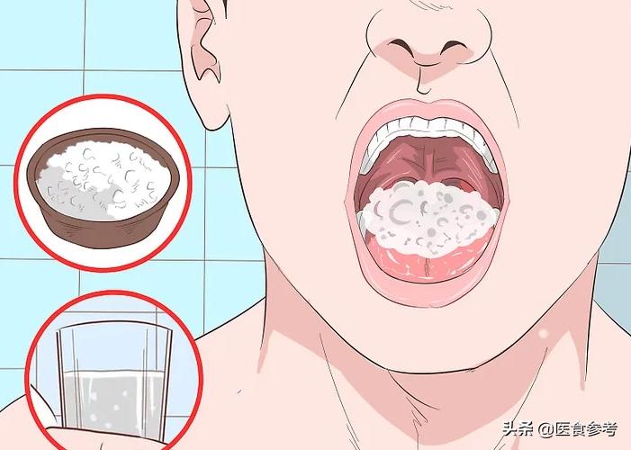 咽部有异物感咳出小肉球,咽部异物感引发咳嗽