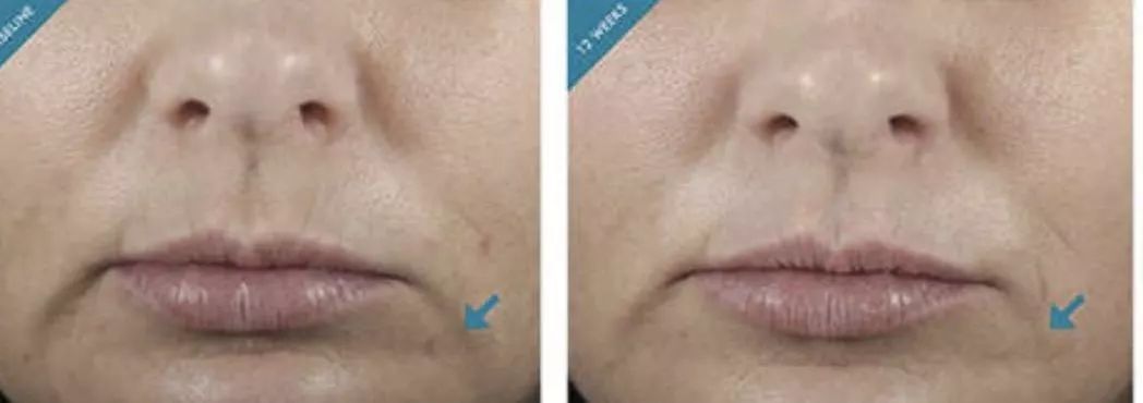 那些你不知道的护肤成分,不踩坑护肤的哪些成分不可忽略