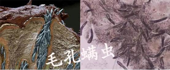 失眠脱发是什么原因造成的,脱发是什么原因造成的呢