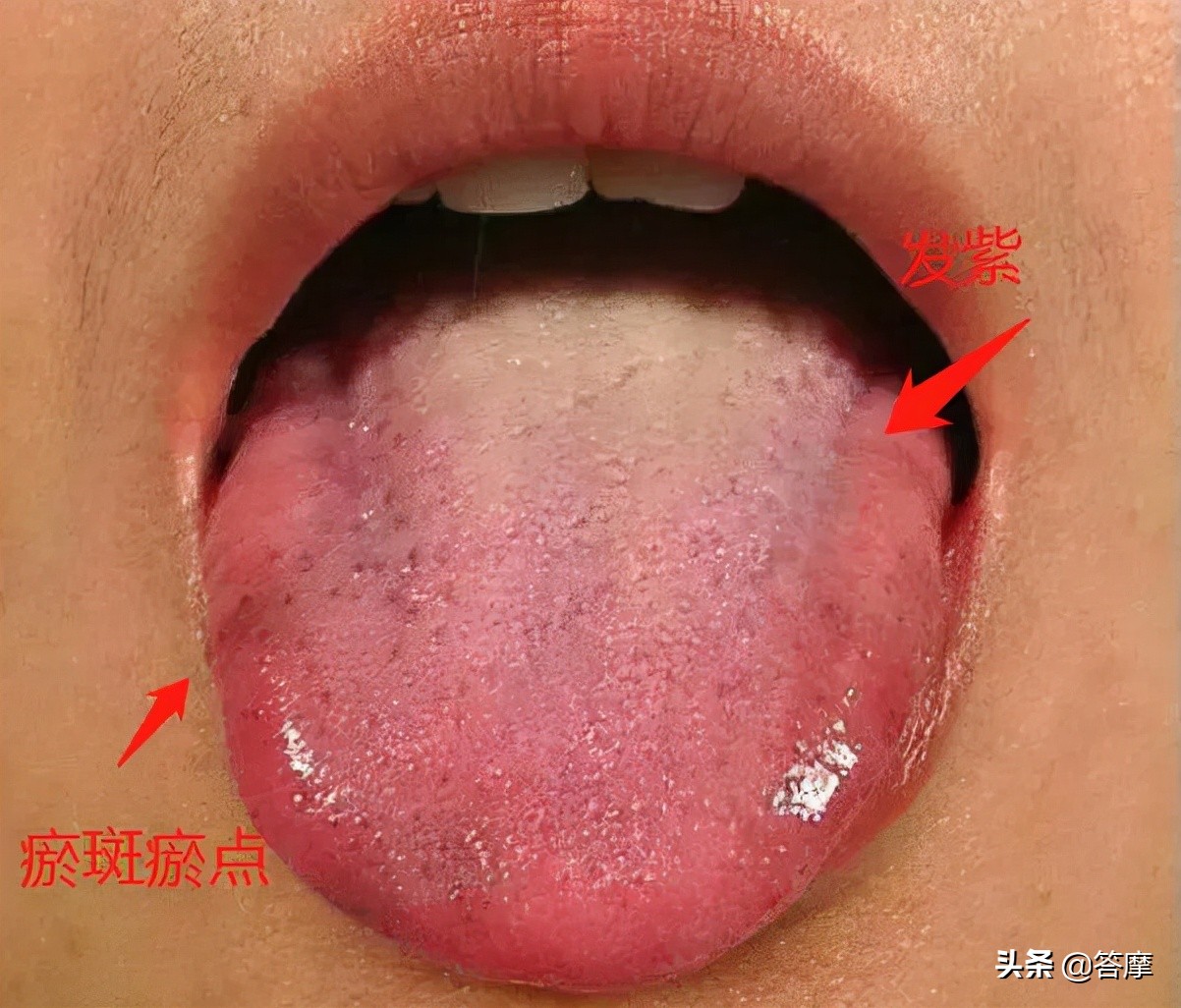 舌象脏腑图,体内有湿寒的舌象