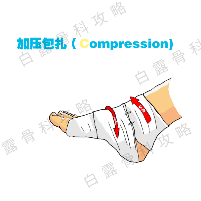 踝关节扭伤紧急处理,踝关节扭伤紧急处理视频