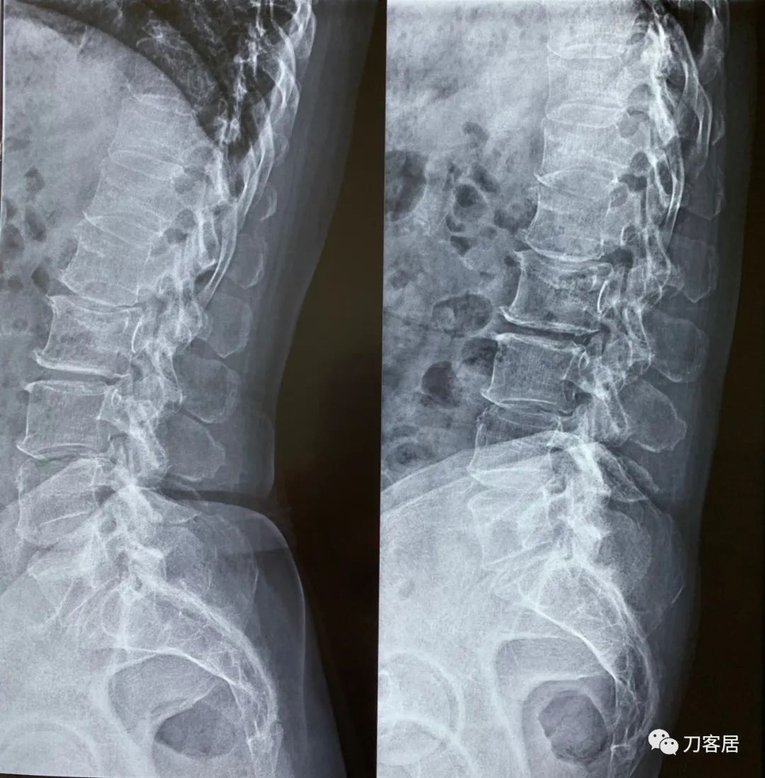 我的门诊病历,我的门诊