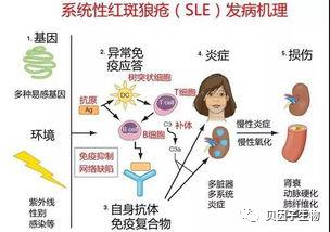 干细胞治疗红斑狼疮效果怎么样,干细胞治疗红斑狼疮有效吗