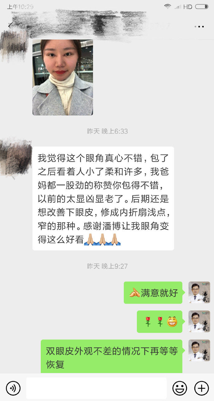 开眼角过大图片,开眼角过大修复效果图