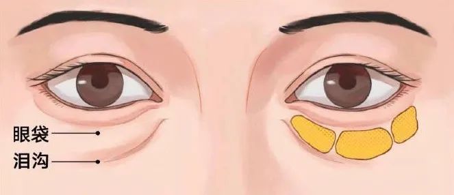 15秒了解眼睛有疾病,120秒轻松解决眼部问题