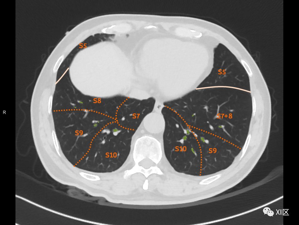如此详细的肺部影像解剖，有点儿酷！