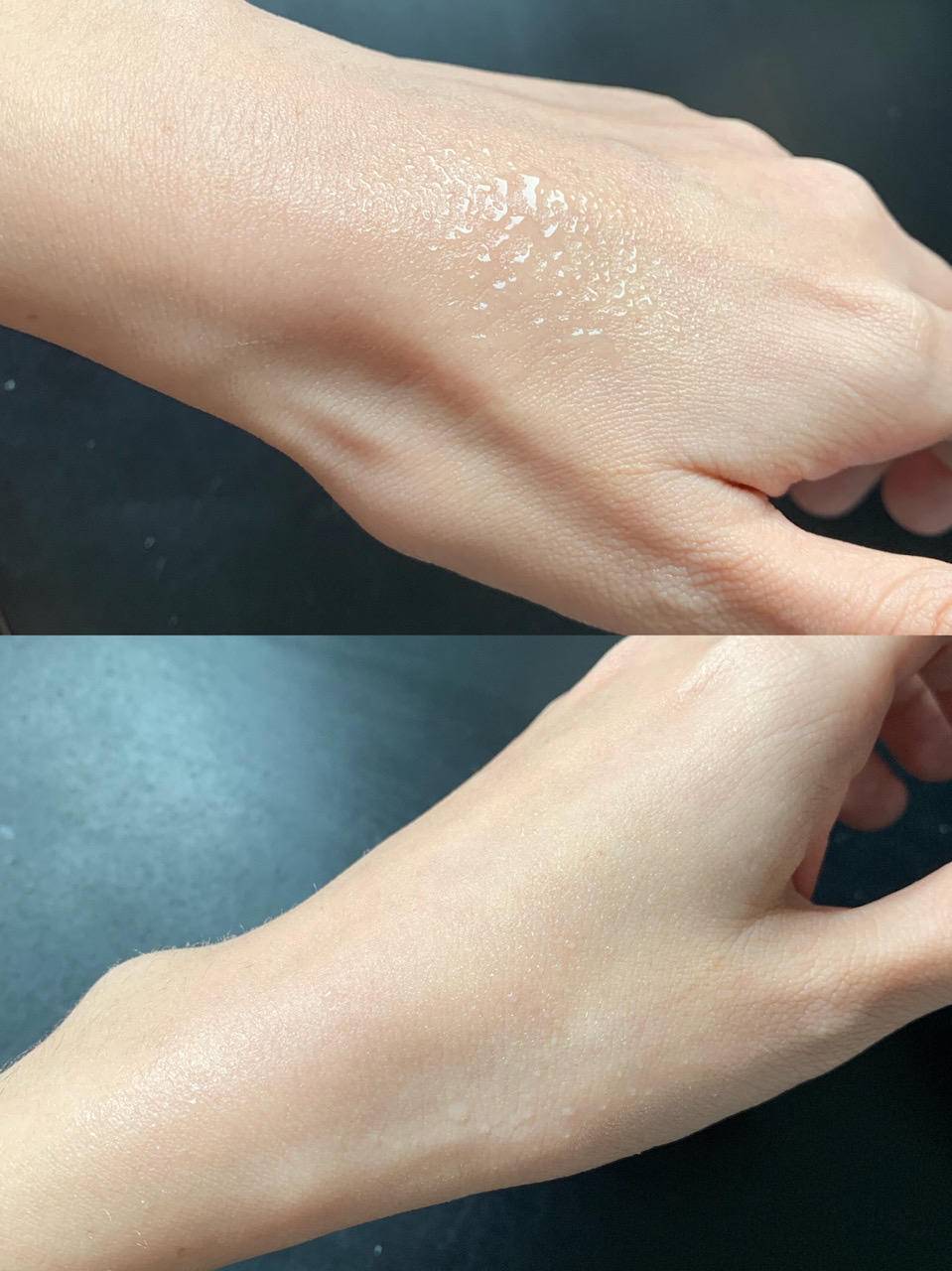 晒后晒伤发红修复最有效的办法,晒后修护可以涂抹晒伤的皮肤吗