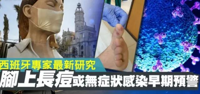 脚趾长水痘发痒脱皮怎么办,脚趾上起小水痘是怎么回事