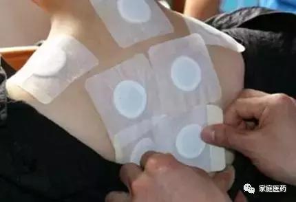 胸锁关节损伤贴什么膏药,关节损伤贴什么膏药