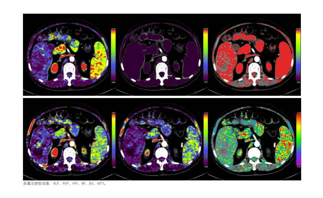 陈宝莹演过的全部电影,陈宝莹电影