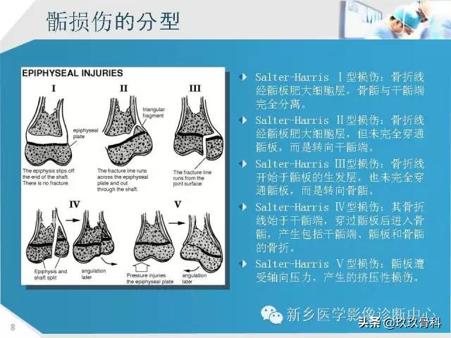 骨骺损伤x线表现,骨骺损伤磁共振表现