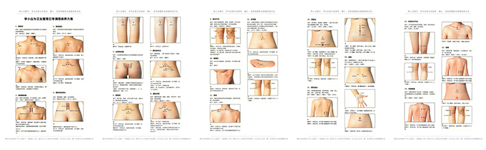 腰肌劳损艾灸治疗，干重体力活的人重灸肾俞别忘记环跳穴效果加倍