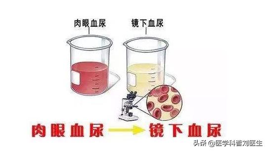如何关注男性健康,关注男性健康养生