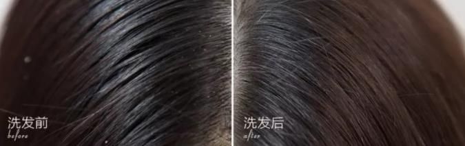 去屑洗发水专业测评,头屑克星去屑止痒洗发水干性皮肤