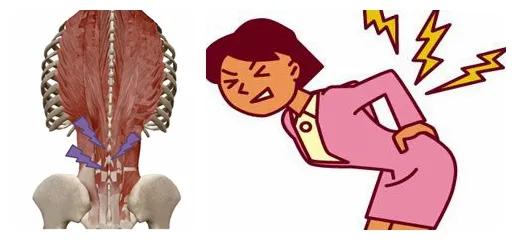 骨科专家讲解久坐的危害,每天做这个动作可以治愈腰椎