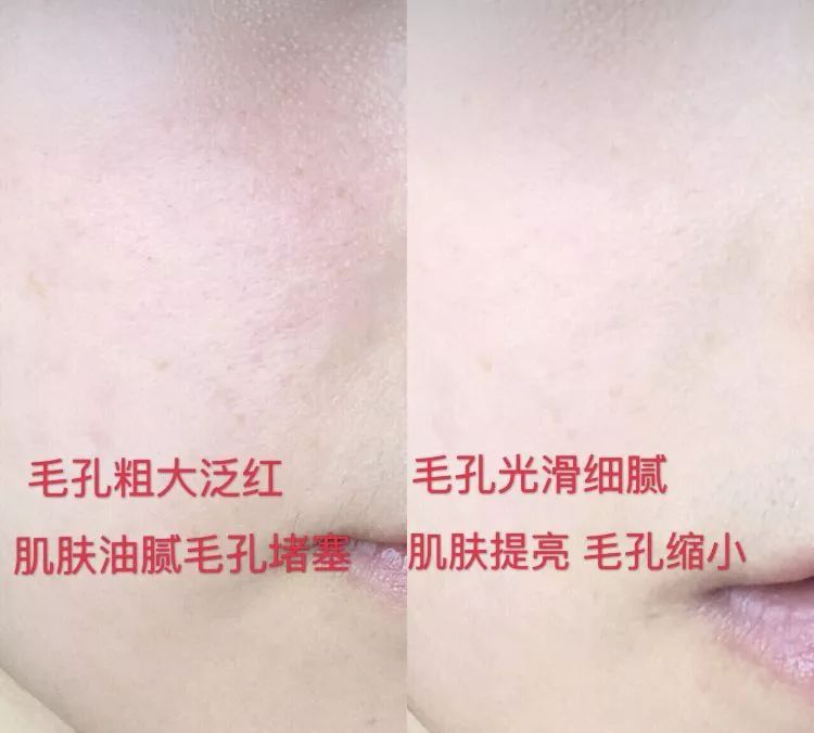 学吴昕洁面，不到40块get千元Luna平替，1个月洗出无暇鸡蛋肌