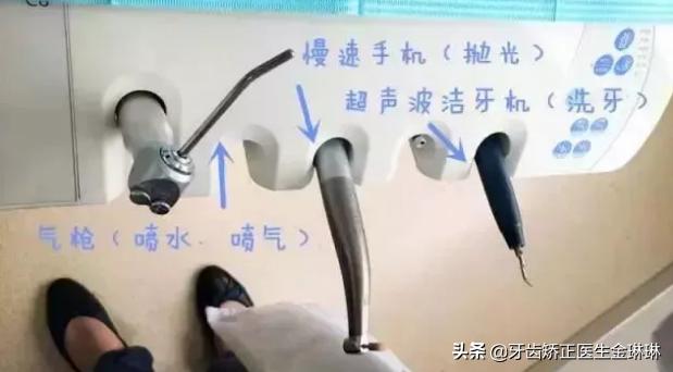 超声波洗牙洁牙是什么,超声波洁牙器洗牙多少钱