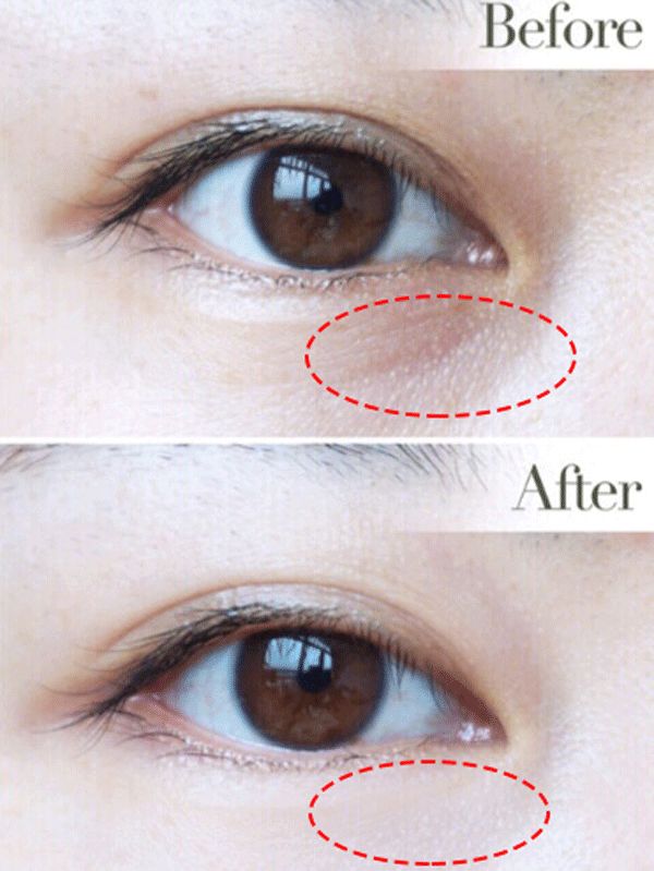 韩国大牌眼霜,吴昕爱马仕眼霜怎么样