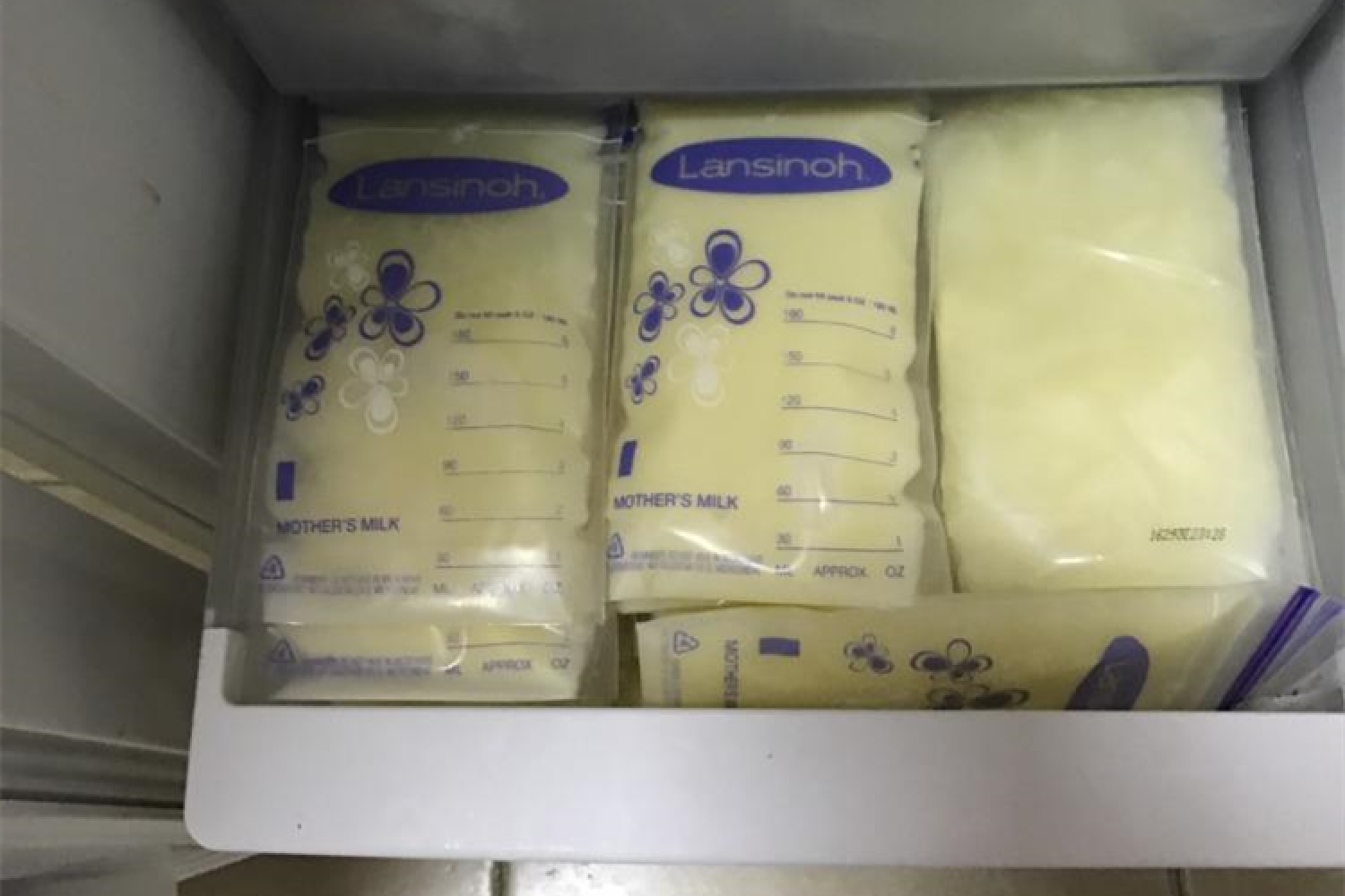 母乳堵奶最好的解决方法,母乳喂养有困难的要及时处理