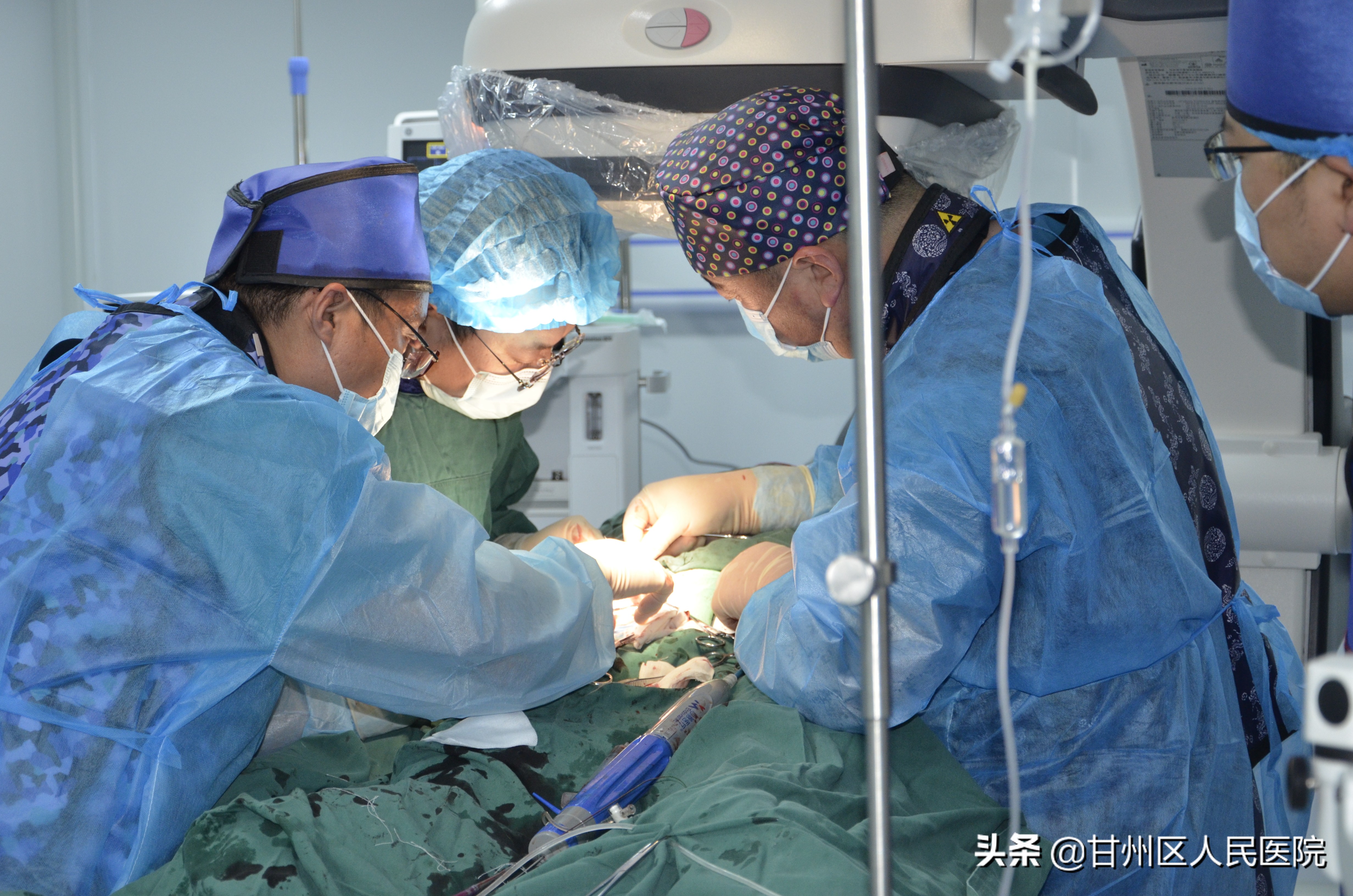 腹主动脉瘤微创手术哪里能做,腹主动脉瘤35毫米做了手术