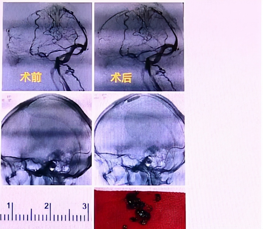 22岁的老师喝奶茶进医院,22岁女孩喝奶茶喝进icu