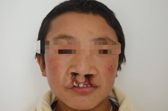 药物因素导致胎儿畸形视频,致胎儿畸形的药有哪些