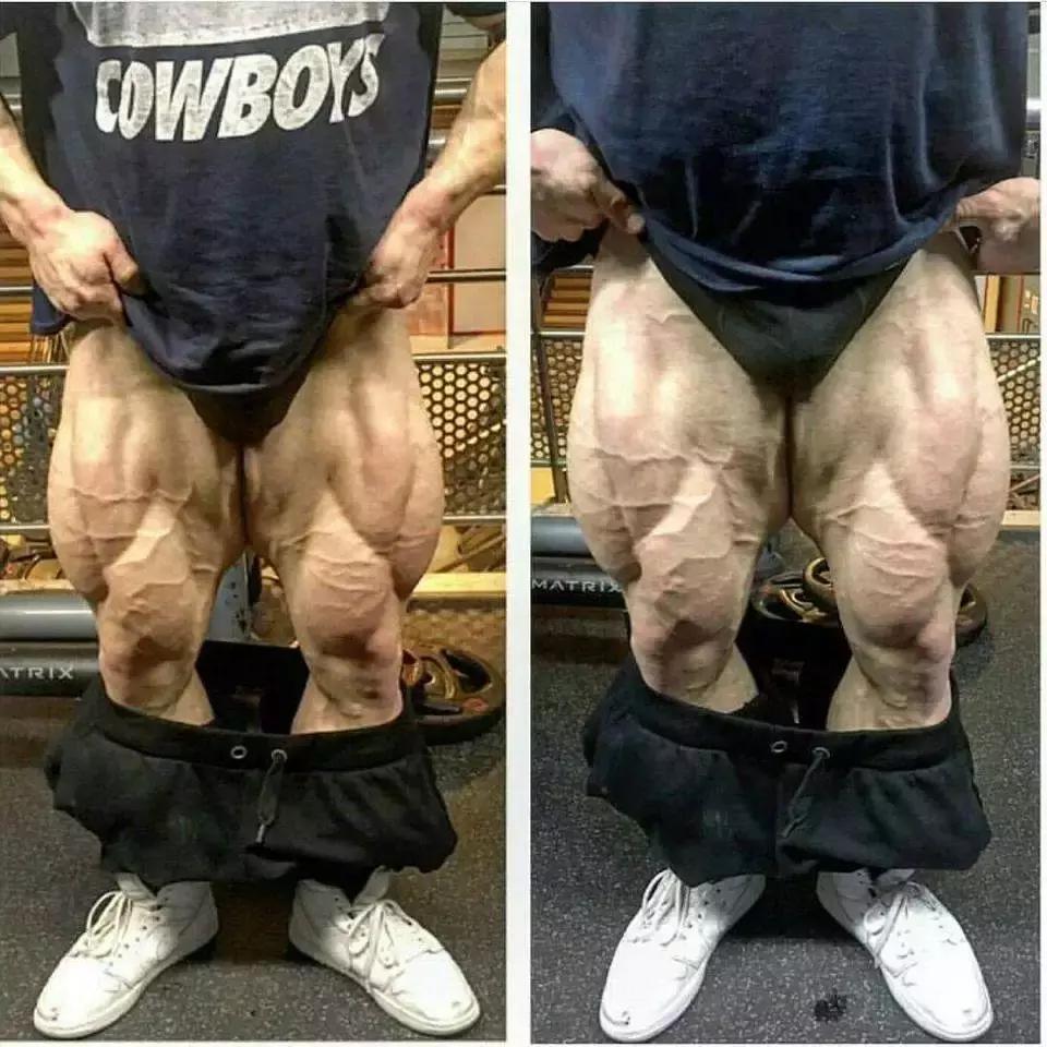 腿部拉筋可以改变腿型吗,腿部训练可以纠正腿型